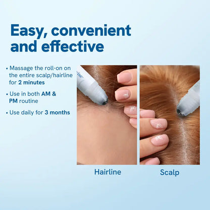 Hair Growth Roll-On Serum – See hair growth in 4 weeks-